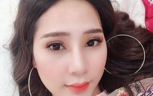 Cắt mí bằng công nghệ hiện đại tạo cho đôi mắt đẹp tự nhiên, bền bỉ