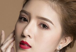 Cắt mí có cần bôi thuốc chống sẹo không?