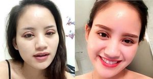 Tay nghề quyết định rất nhiều đến hiệu quả cắt mí