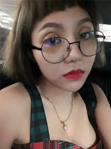 Cắt mí bị to có sửa được không? Cách chữa cắt mí bị quá to