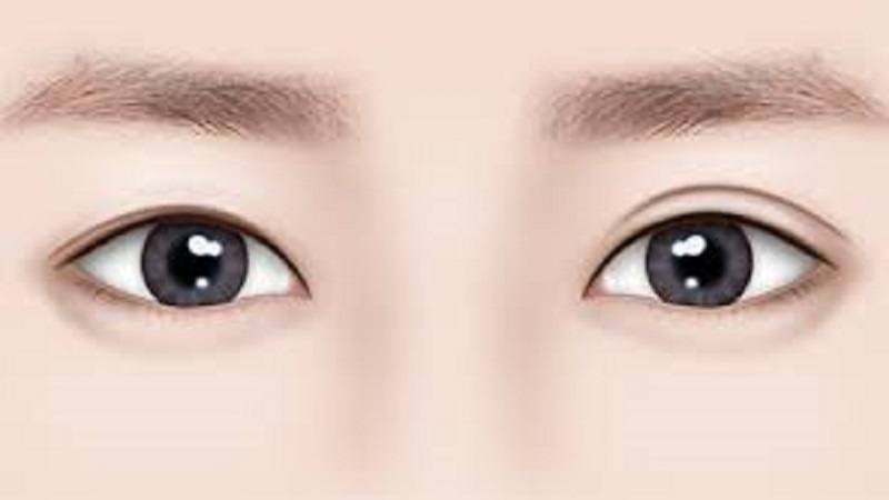 Cắt mí mini deep có rất nhiều ưu điểm vượt trội