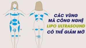 Công dụng nổi trội của công nghệ giảm béo mới nhất