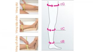 Tiêu chuẩn chung chung để xác định béo bắp chân