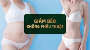 Giảm béo không phẫu thuật như thế nào?