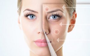 Nguyên nhân điều trị mụn mãi không hết?