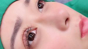 Cắt mí mắt bao nhiêu tiền