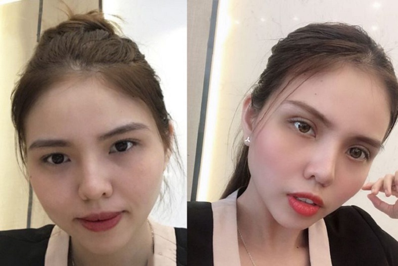 Nhấn mí mắt mang đến sự khác biệt cho đôi mắt của bạn