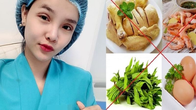 Kiêng ăn gì sau khi cắt mí mắt?