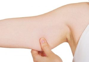 Cách giảm mỡ bắp tay cấp tốc
