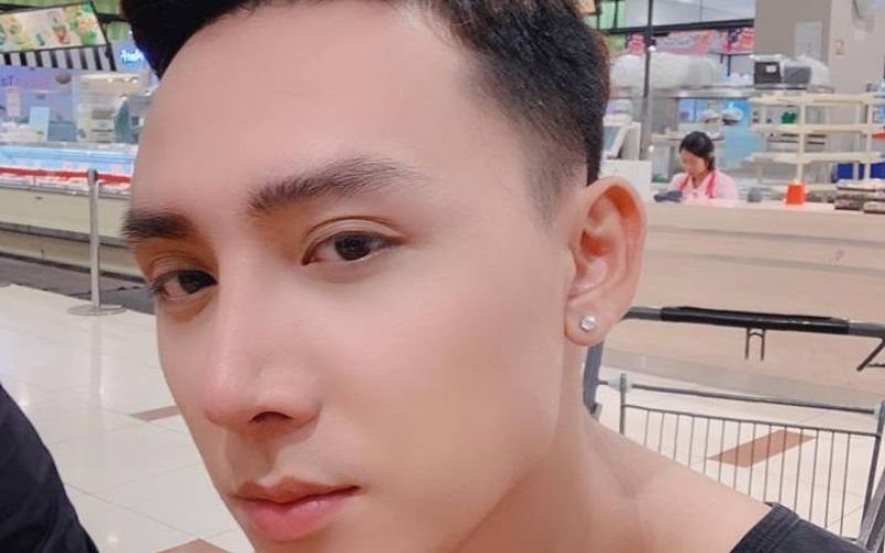 Con trai có nên cắt mí mắt?