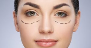 Tìm kiếm một địa chỉ cắt mí đẹp và an toàn là tiêu chí hàng đầu của chị em