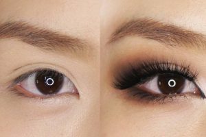 Lồn mi ngắn - lông mi thưa có thể do bẩm sinh