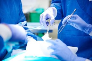 Phẫu thuật cắt tuyến mồ hôi kinh điển