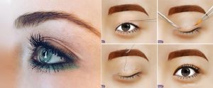 Bấm mí (nhấn mí mắt) ở cơ sở thẩm mỹ uy tín sẽ có chi phí hợp lý