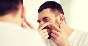 Có nhiều nguyên nhân dẫn đến mụn ở nam giới đặc biệt là những người da dầu