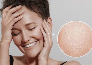                     Da dầu, nhờn rít khiến bạn trông mất tự tin.