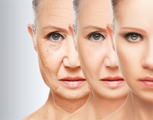                     Phẫu thuật căng da mặt giúp bạn trẻ hóa làn da.
