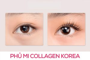 Phủ mi collagen khiến mi mắt trong rất tự nhiên