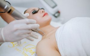 Xóa nốt ruồi bằng laser rất được ưa chuộng