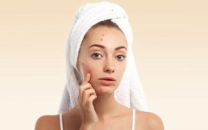 Da dầu mụn làm mất thẩm mỹ khuôn mặt
