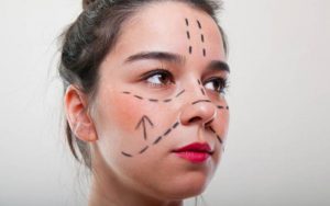 Phẫu thuật thẩm mỹ ít nhiều cũng sẽ để lại sẹo