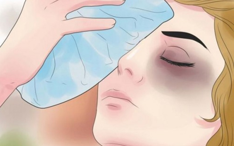 Chườm đá giúp giảm sưng và dịu mắt nhanh chóng