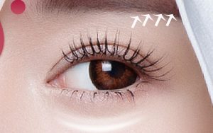 ­Nhấn mí là tiểu phẫu đơn giản, tuy nhiên vẫn để lại sưng nề sau khi thực hiện