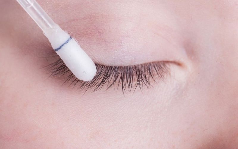 Chăm sóc mí mắt đúng cách giúp hạn chế tối đa bị sẹo