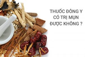 Lý do trị mụn với thuốc đông y