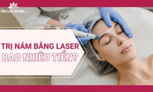 Trị nám da với laser bao nhiêu tiền?