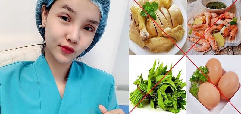 Đặc biệt chú trọng những nhóm thực phẩm sau khi cắt mí mắt