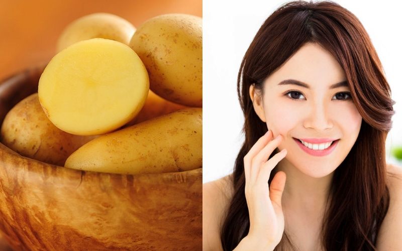Khoai tây có thể đánh bay thâm mắt nhanh chóng