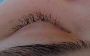 Mi uốn bị cong quá mức không thể tự quay về trạng thái ban đầu