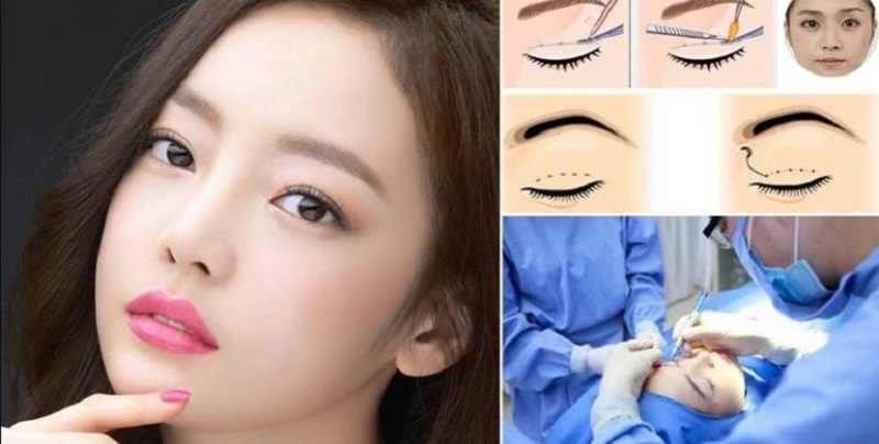 Sau cắt mí cần tránh trang điểm để không ảnh hưởng đến hồi phục vết thương