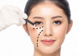 Địa chỉ cắt mí dưới ở đâu đẹp và uy tín nhất hiện nay?