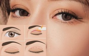 Cắt mí mắt Hàn Quốc tạo ra đôi mắt 2 mí to tròn tự nhiên