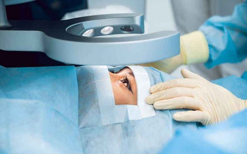 Cắt mí mắt Plasma giúp trẻ hóa đôi mắt