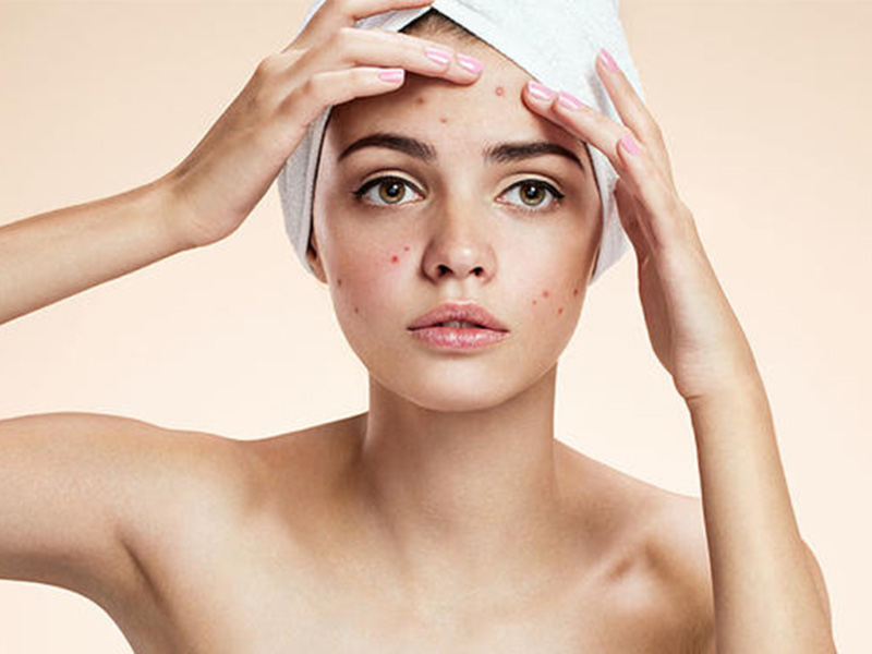 Ở spa có những ưu điểm nào giúp chúng ta chăm sóc cho da mụn?