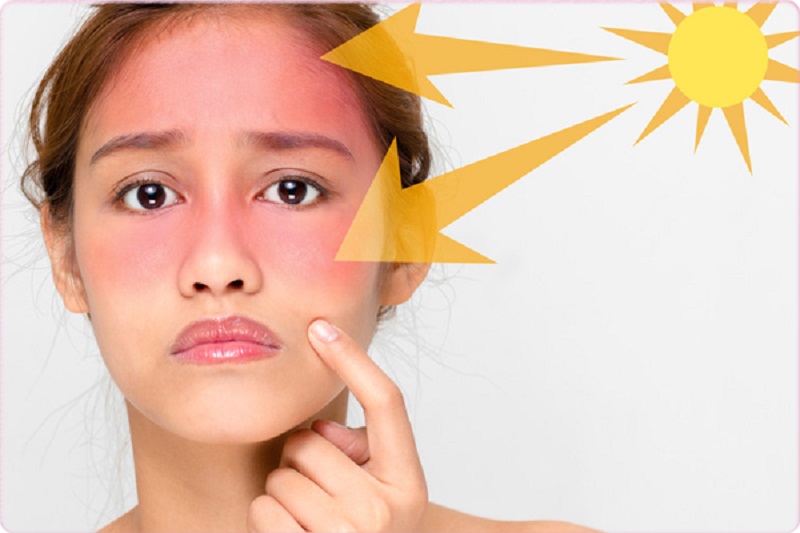 Tia UV chính là nguyên nhân gây tổn thương da