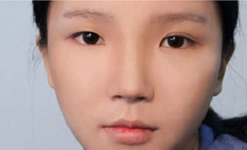Mí mắt không đều là khuyết điểm lớn cần thay đổi