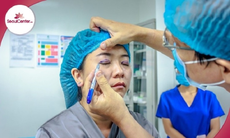 Nhấn mí là công nghệ có thể cải thiện khuyết điểm mí mắt không đều