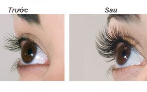 Cắt lông mi ở người lớn là việc được nhiều người thực hiện