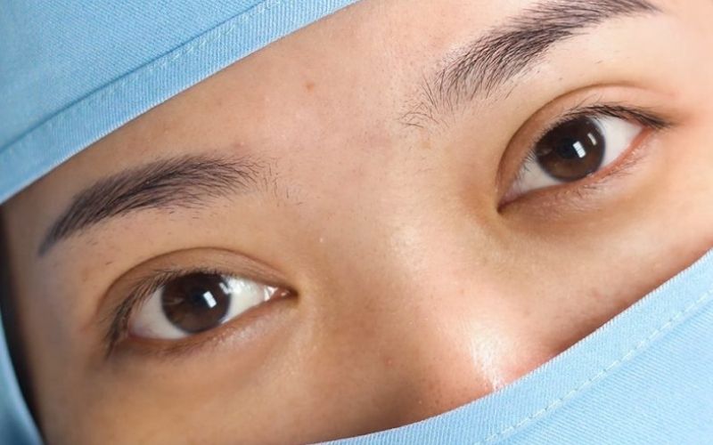 Công nghệ cắt mí hiện đại sẽ giúp mắt nhanh đẹp