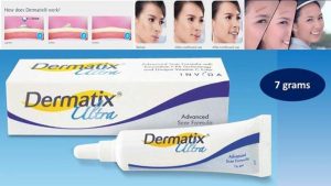 Dermatix Ultra thường được chọn lựa khi được hỏi cắt mí nên dùng thuốc trị sẹo nào