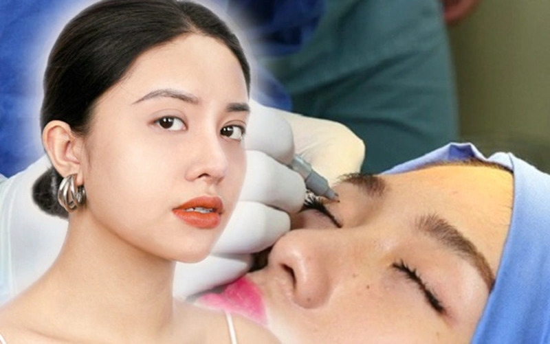 Độ tuổi phù hợp để cắt mí là vấn đề rất quan trọng cần được làm rõ