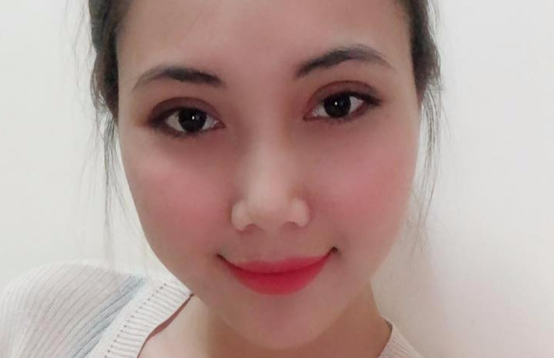 Hiện nay có 3 phương pháp cắt mí mắt phổ biến tại các trung tâm thẩm mỹ