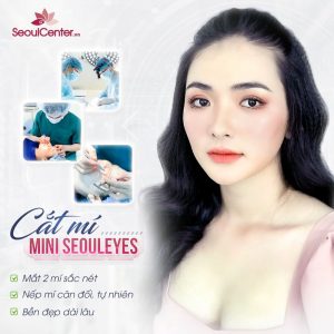 Cắt mí sẽ giúp bạn loại bỏ toàn bộ những khuyết điểm xấu xí tại mắt
