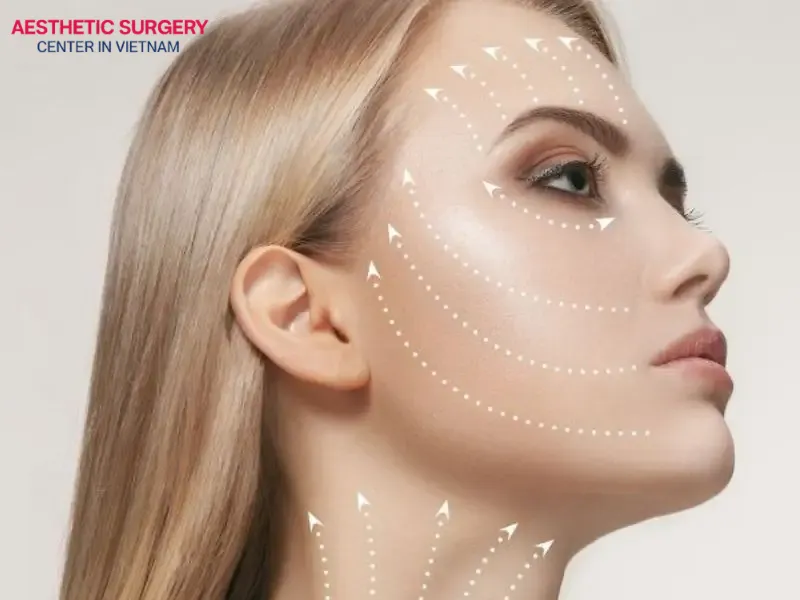 A facelift is a skin rejuvenation procedure widely chosen by women
