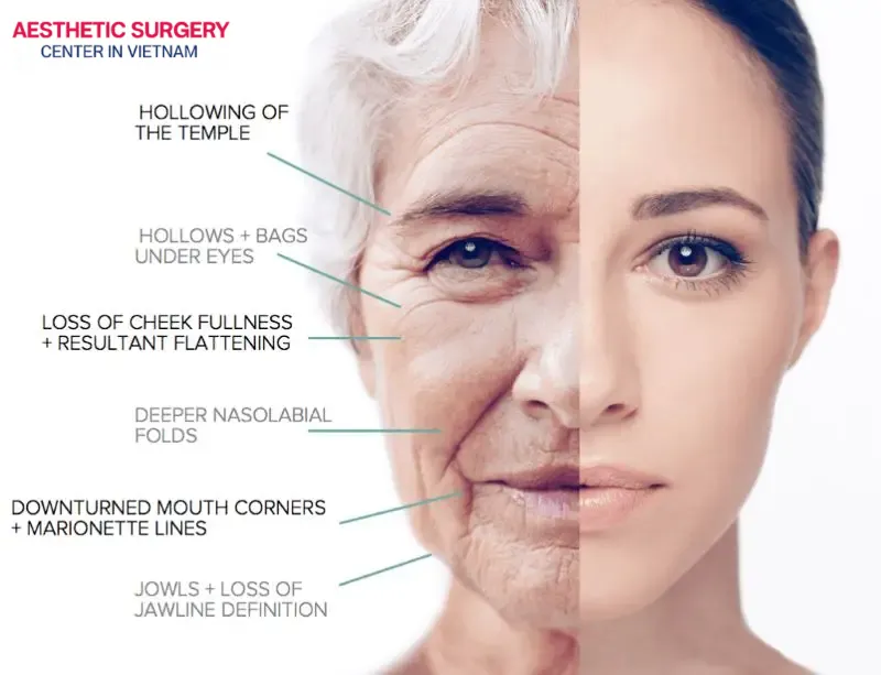 Dermal fillers offer a wide range of great benefits 