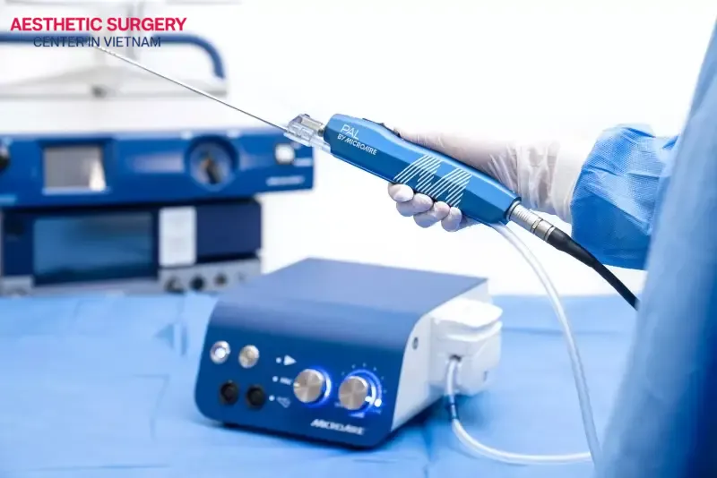 The more advanced the liposuction technology, the higher the cost